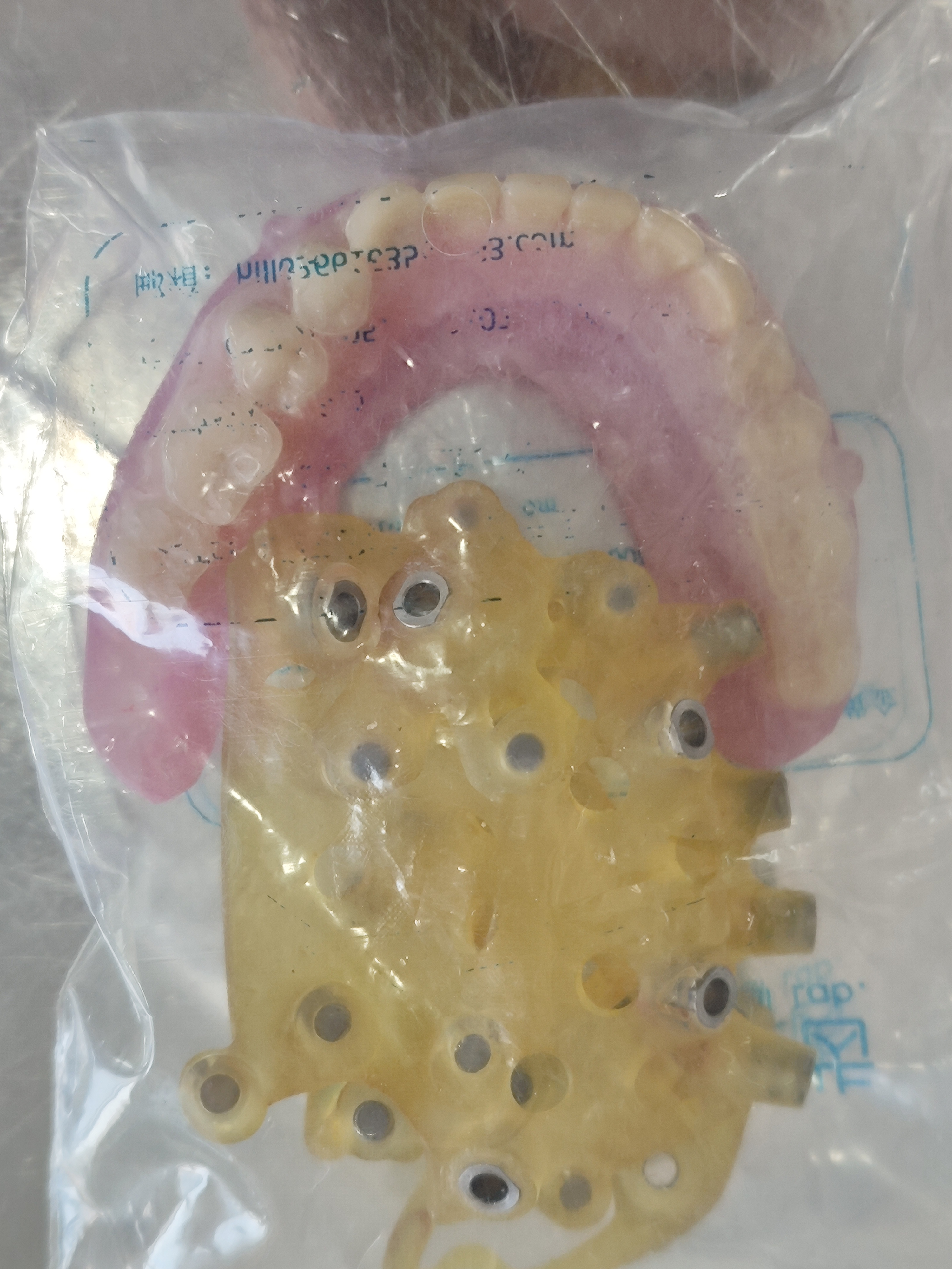 上海黄浦区补牙实惠之选